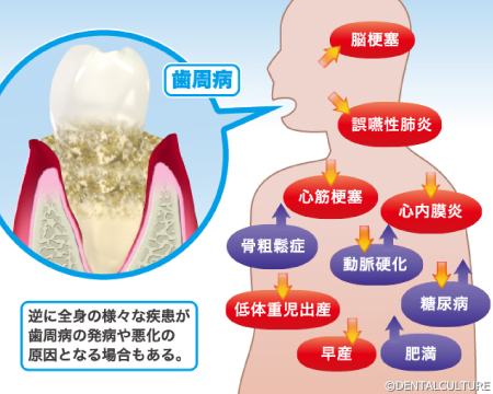 全身疾患等の関係